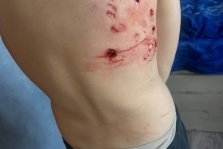 выкса.рф, После нападения собаки на ребёнка в Кулебаках возбуждено уголовное дело о халатности